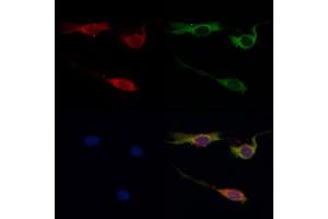 ABIN6259651 and ABIN6268999 staining HepG2 by IF/ICC. (Serotonin Receptor 1A antibody  (Internal Region))