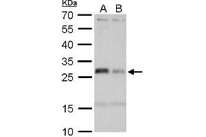 WB Image HLA-DMA antibody detects HLA-DMA protein by Western blot analysis. (HLA-DMA antibody)