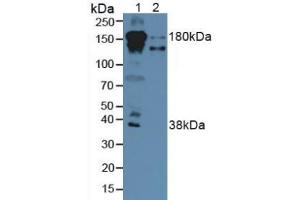Western blot analysis of (1) Human Serum and (2) Human Liver Tissue. (Complement Factor H antibody  (AA 860-1231))