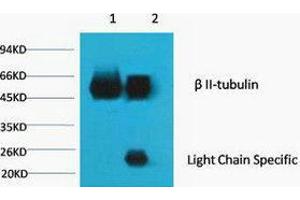 Immunoprecipitation (IP) analysis: 1) Input: Mouse Brain Tissue Lysate. (TUBB2A antibody)