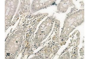 ABIN6257502 and ABIN6274398 at 1/100 staining human normal colon tissue by IHC-P. (STEAP4 antibody  (C-Term))