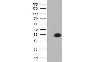 HEK293T cells were transfected with the pCMV6-ENTRY control (Left lane) or pCMV6-ENTRY KHK (Right lane) cDNA for 48 hrs and lysed. (Ketohexokinase antibody)