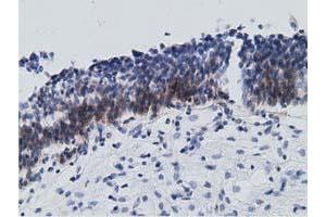 Immunohistochemical staining of paraffin-embedded Human bladder tissue using anti-RBBP9 mouse monoclonal antibody. (RBBP9 antibody)