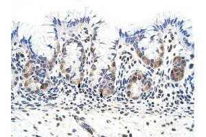 PRKRA antibody was used for immunohistochemistry at a concentration of 4-8 ug/ml to stain Epithelial cells of fundic gland (arrows) in Human Stomach. (PRKRA antibody  (Middle Region))