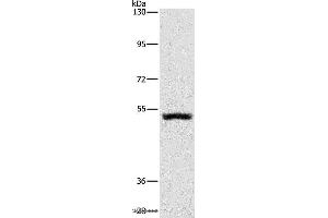 Western blot analysis of Mouse kidney tissue, using SYT17 Polyclonal Antibody at dilution of 1:650 (SYT17 antibody)
