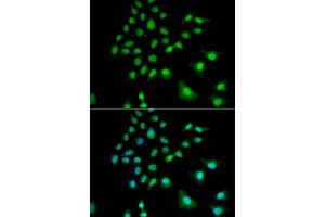 Immunofluorescence analysis of U2OS cells using UBE3C antibody (ABIN5973842). (UBE3C antibody)