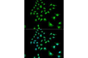 Immunofluorescence analysis of U2OS cells using UBE3C antibody (ABIN5973842). (UBE3C antibody)