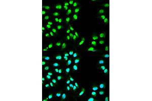 Immunofluorescence analysis of HeLa cell using MCM3 antibody. (MCM3 antibody  (AA 1-295))