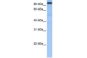 WB Suggested Anti-CPSF2 Antibody Titration:  0.