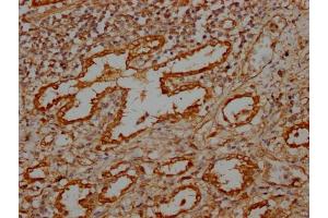 IHC image of ABIN7159372 diluted at 1:100 and staining in paraffin-embedded human lung tissue performed on a Leica BondTM system. (MBTPS1 antibody  (AA 187-400))