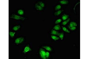 Immunofluorescent analysis of MCF-7 cells using ABIN7172301 at dilution of 1:100 and Alexa Fluor 488-congugated AffiniPure Goat Anti-Rabbit IgG(H+L) (NFKBIL2 antibody  (AA 668-955))