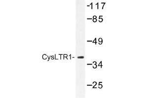Image no. 1 for anti-Cysteinyl Leukotriene Receptor 1 (CYSLTR1) antibody (ABIN317631) (CysLTR1 antibody)