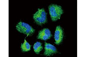 Confocal immunofluorescent analysis of CHAT Antibody (N-term) (ABIN653544 and ABIN2842929) with NCI- cell followed by Alexa Fluor? (Choline Acetyltransferase antibody  (N-Term))