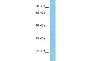 Host:  Rabbit  Target Name:  GAMT  Sample Type:  NCI-H226 Whole Cell lysates  Antibody Dilution:  1. (GAMT antibody  (N-Term))