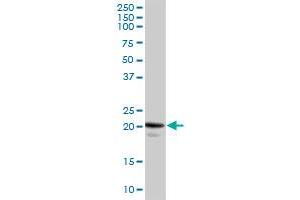 Western Blotting (WB) image for anti-Caveolin 1, Caveolae Protein, 22kDa (CAV1) (AA 1-178) antibody (ABIN514037)