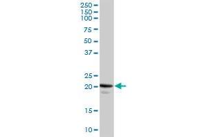 CAV1 MaxPab rabbit polyclonal antibody. (Caveolin-1 antibody  (AA 1-178))