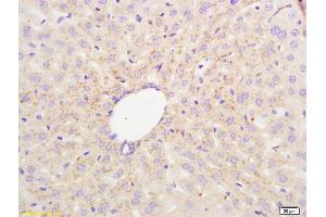 Formalin-fixed and paraffin embedded mouse liver labeled with Anti-STSL/ABCG8 Polyclonal Antibody, Unconjugated (ABIN1387509) at 1:200 followed by conjugation to the secondary antibody and DAB staining. (ABCG8 antibody  (AA 566-673))