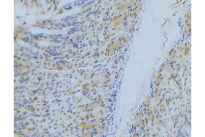 ABIN6277300 at 1/100 staining Human gastric tissue by IHC-P. (NDUFS1 antibody  (N-Term))