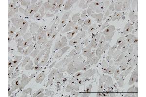 Immunoperoxidase of monoclonal antibody to MECP2 on formalin-fixed paraffin-embedded human heart. (MECP2 antibody  (AA 81-170))