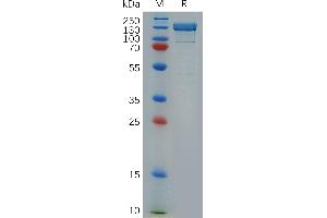 SDS-PAGE (SDS) image for Integrin beta 1 (ITGB1) (AA 21-728) protein (Fc Tag) (ABIN6964137)