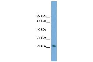 WB Suggested Anti-RAB15 Antibody Titration: 0. (RAB15 antibody  (Middle Region))