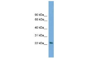 WB Suggested Anti-RAB15 Antibody Titration: 0. (RAB15 antibody  (Middle Region))