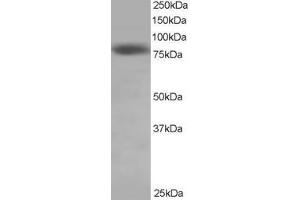 Western Blotting (WB) image for anti-NDC80 Kinetochore Complex Component Homolog (NDC80) (C-Term) antibody (ABIN2465807)