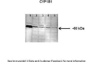 Lanes:  Lane 1: Human lung microsome lysate Lane 2-5: 150 ug mouse lung microsome lysate Primary Antibody Dilution:  1: 1000 Secondary Antibody:  Anti-rabbit HRP Secondary Antibody Dilution:  1: 10000 Gene Name:  CYP1B1 Submitted by:  Jing Peng, Fox Chase Cancer Center (CYP1B1 antibody  (Middle Region))