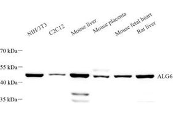 ALG6 antibody