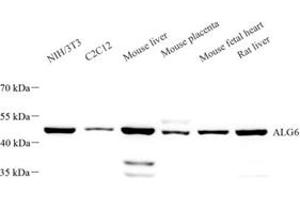 Western blot analysis of ALG6 (ABIN7073127) at dilution of 1: 1000 (ALG6 antibody)