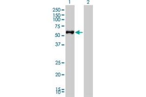 Western Blotting (WB) image for anti-Fibrinogen-Like 2 (FGL2) (AA 24-123) antibody (ABIN564725)