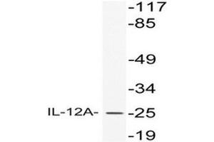 Western blot (WB) analysis of IL-12A antibody in extracts from HeLa cells. (IL12A antibody)