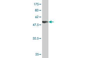 Western Blot detection against Immunogen (52. (UNC119 antibody  (AA 1-240))