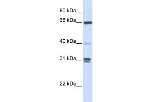 WB Suggested Anti-GBP2 Antibody Titration: 0.