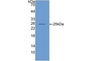 Western blot analysis of recombinant Mouse COMP. (COMP antibody  (AA 554-753))
