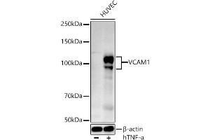 Western blot analysis of extracts of HUVEC cells, using VC antibody (ABIN3020868, ABIN3020869, ABIN3020870 and ABIN6213763) at 1:524 dilution.