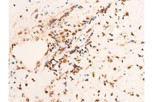 Immunohistochemistry (IHC) image for anti-Checkpoint Kinase 1 (CHEK1) (pSer296) antibody (ABIN6256251)
