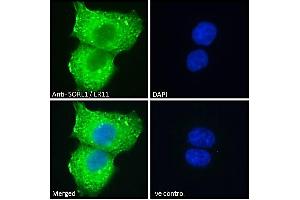 ABIN184579 Immunofluorescence analysis of paraformaldehyde fixed A431 cells, permeabilized with 0. (SORL1 antibody  (C-Term))