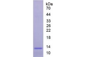 SDS-PAGE analysis of Human Melatonin Receptor 1A Protein. (Melatonin Receptor 1A Protein (MTNR1A))