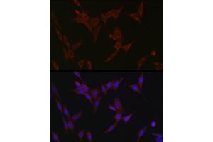 Immunofluorescence analysis of NIH/3T3 cells using ZIP14 Rabbit pAb (ABIN6133191, ABIN6147993, ABIN6147994 and ABIN6214658) at dilution of 1:100 (40x lens). (SLC39A14 antibody  (AA 240-340))