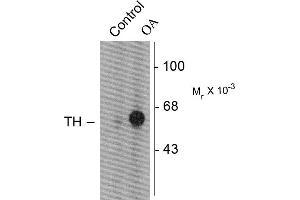 Western blots of PC-12 cells incubated in the absence (Control) and presence of okadaic acid (OA, 1 µM for 60 min) showing specific immunolabeling of the ~60k TH phosphorylated at Ser31. (Tyrosine Hydroxylase antibody  (pSer31))