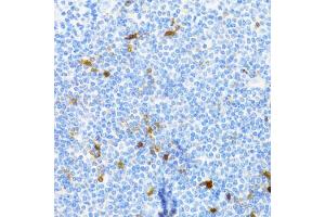 Immunohistochemistry of paraffin-embedded human tonsil using PVALB Antibody (ABIN5971476) at dilution of 1/100 (40x lens).