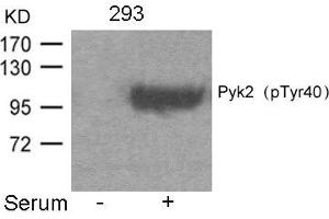Western blot analysis of extracts from 293 cells untreated or treated with Serum using Pyk2(Phospho-Tyr402) Antibody. (PTK2B antibody  (pTyr402))