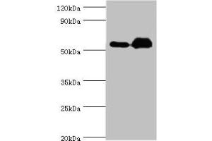 Western blot All lanes: Retinal dehydrogenase 2 antibody at 9 μg/mL Lane 1: K562 whole cell lysate Lane 2: Mouse liver tissue Secondary Goat polyclonal to rabbit IgG at 1/10000 dilution Predicted band size: 57, 54, 55, 47 kDa Observed band size: 57 kDa