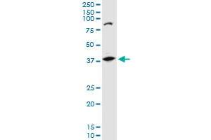 AKR1B10 polyclonal antibody (A01), Lot # UOP11060207QCS1. (AKR1B10 antibody  (AA 76-143))