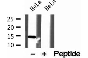 Western blot analysis of extracts of HeLa cells, using UQCRB antibody. (UQCRB antibody  (N-Term))