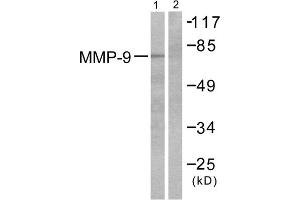 Western blot analysis of extracts from HepG2 cells, using MMP9 antibody (ABIN5976466). (MMP 9 antibody  (C-Term))