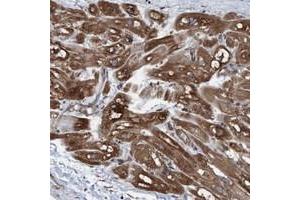 Immunohistochemical staining of human heart muscle with GARNL4 polyclonal antibody  shows distinct cytoplasmic positivity in myocytes at 1:200-1:500 dilution. (RAP1GAP2 antibody)