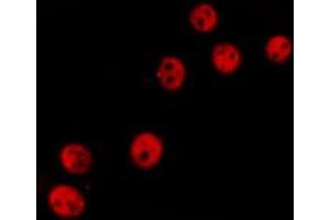 ABIN6277236 staining  Hela cells by IF/ICC. (TCOF1 antibody  (N-Term))