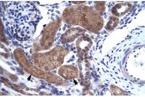 Human kidney (IKZF2 antibody  (C-Term))